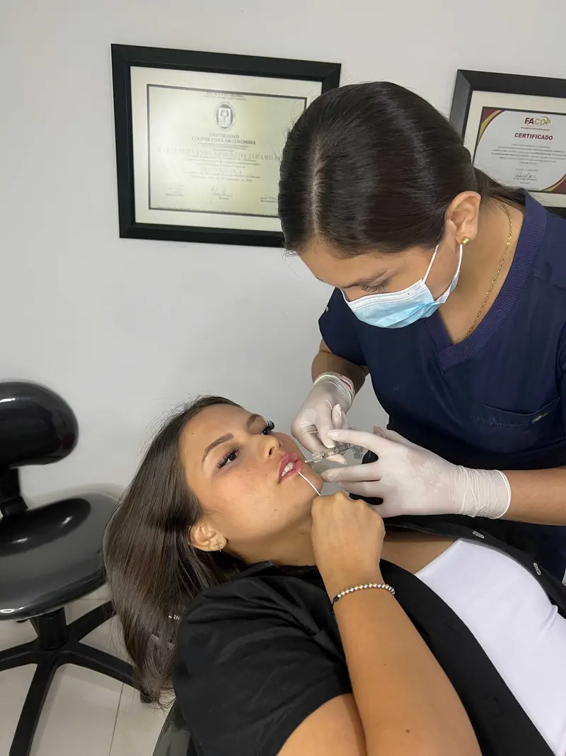 Dra. María Fernanda Arboleda aplicando ácido hialurónico en los labios de una paciente
