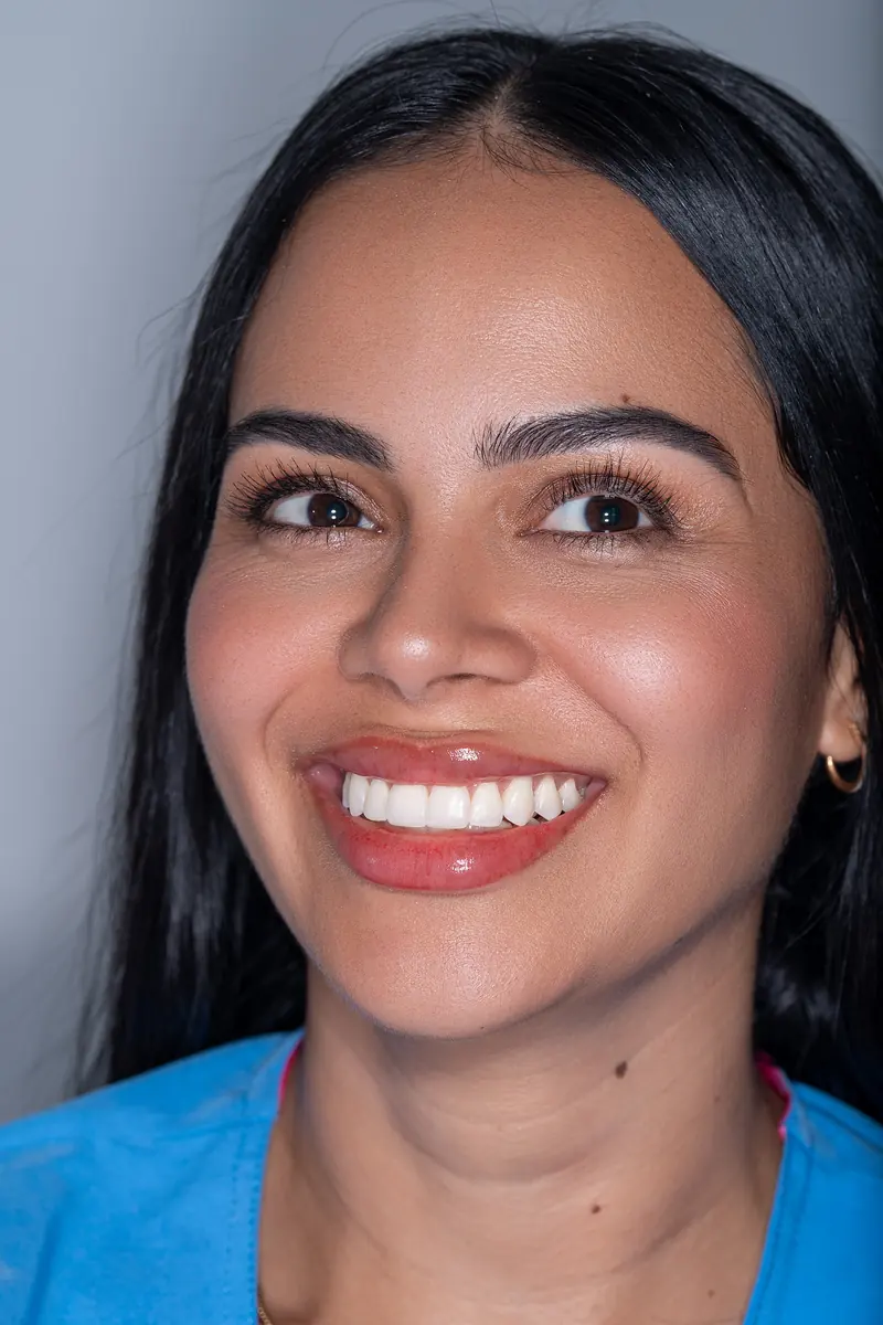 Paciente sonriendo tras la restauración de bordes incisales en Villavicencio