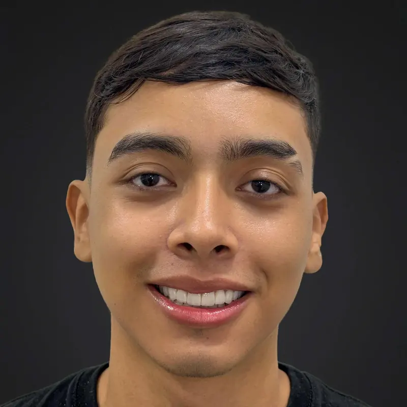 Paciente con diseño de sonrisa en cerómeros