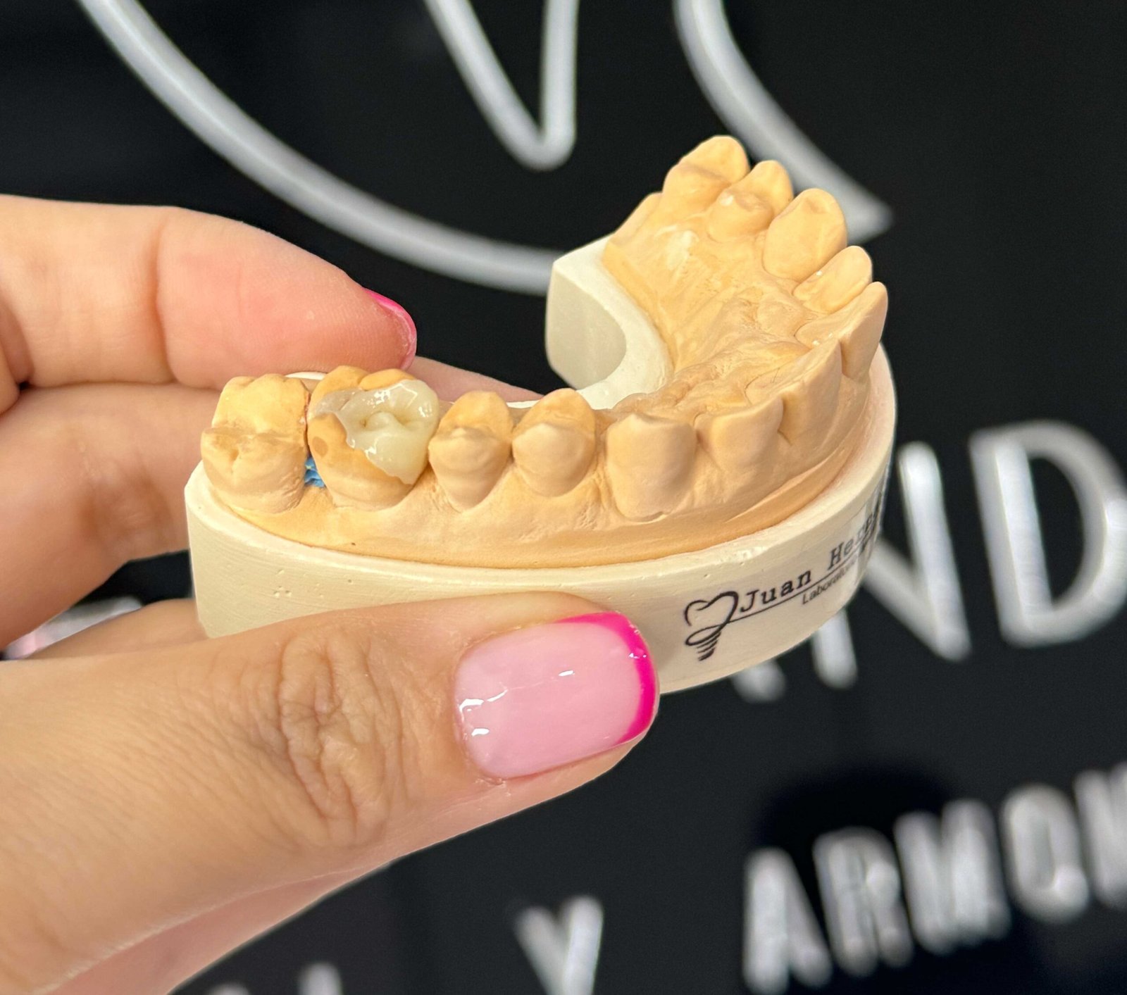 restauracion restauracion